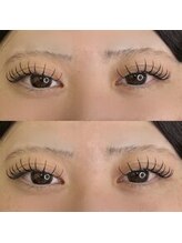 バニーアイズ 天神(Bunny eyes TENJIN)/フラット160本