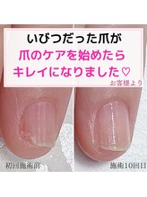 ミミ(mimi)/爪のケアでキレイになれました！