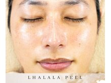 ゼロ アンド リセット(0ZERO&RESET)/【メンズ脱毛】0ZERO&RESET