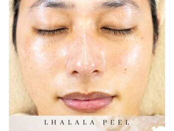 ゼロ アンド リセット(0ZERO&RESET)/【メンズ脱毛】0ZERO&RESET