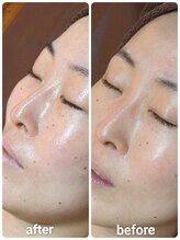 ウララ(ulala)/40代前半