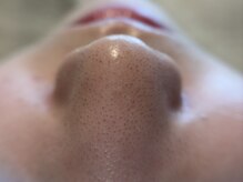 リセットプラス(Reset+)/