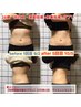 大人気【短期集中ダイエットプラン】30日間/5回ダイエットモニター　（痩身）