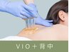 背中の産毛も綺麗に☆【シュガーリングVIO＋背中】17050円→13500円