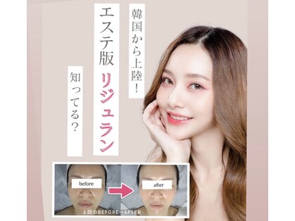 チャルム(CAL'ME)の写真