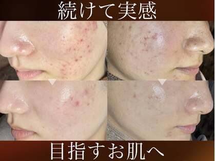 ブラックボックス(BLACK BOX)の写真