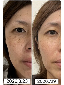 コモドの写真/憧れのハリツヤ肌へ！ほうれい線・シミ・シワ・たるみケアは当サロンへ◎