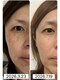 コモドの写真/憧れのハリツヤ肌へ！ほうれい線・シミ・シワ・たるみケアは当サロンへ◎
