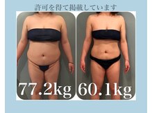 ボディエステティック アクアオーラ 高岡店/157センチ / 20代