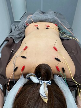 ハリサロンドオフ 堺東店(hari salon de off)/【全身鍼+整体】