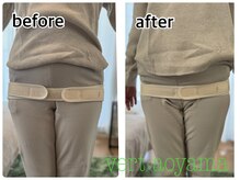 ヴェール 青山(vert)/骨盤矯正ビフォーアフター