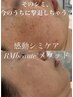 ★不動の人気【シミケア20分当て放題＆プラズマ】同時に受けたい方へ5,500円