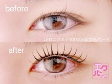 リノ(Lino)/エクパーマ100本 (C10mmのみ)