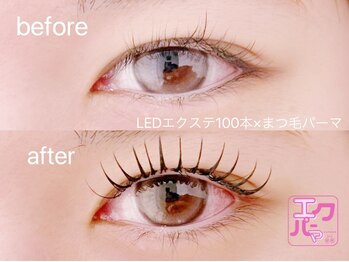 リノ(Lino)/エクパーマ100本 (C10mmのみ)