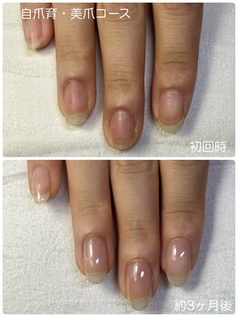 ネイルブルームーン(Nail Blue Moon)/自爪育・美爪コース