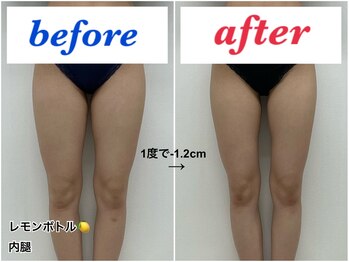アモーラ(Amora)/レモンボトル内腿