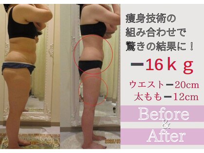 イーズ ミュゼ 梅田本店の写真