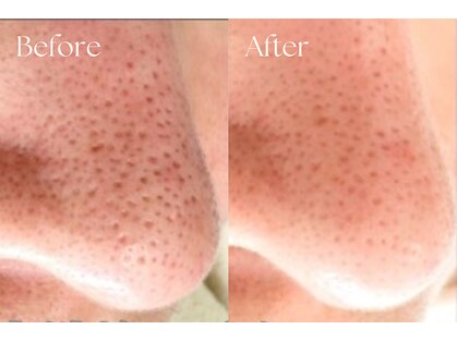 エンビロンサロン エイジングルーム ラヴィーア(Lavia)の写真