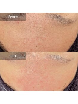 モンレーヴ/結果の出るハーブ