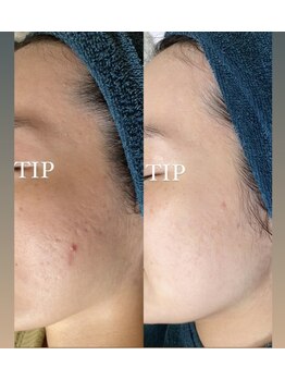 ソランザサロン(Solan the salon)/気になるお悩みははやめに改善