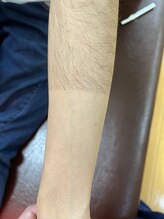 カーム(CALM)/【この違い♪♪】