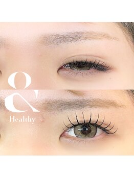 シャルム(Charme)/アンドヘルシー120本