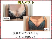 ニコ 岐南本店(Nico)/バスト★before→after
