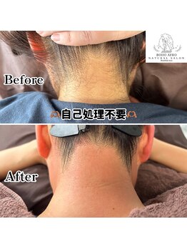 ボーホーアフロ(BOHO AFRO)/うなじ脱毛
