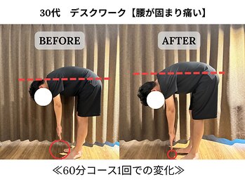 240鍼灸マッサージ院 麻布十番/１回の施術　ビフォーアフター