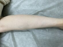 ナノハナ/鹿沼市の全身脱毛美容室ナノハナ