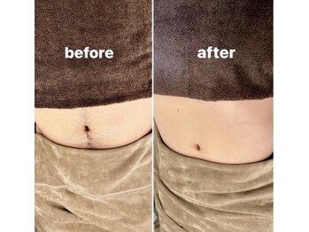 メンズ シンバ(SIMBA)/☆ ビフォーアフター ☆