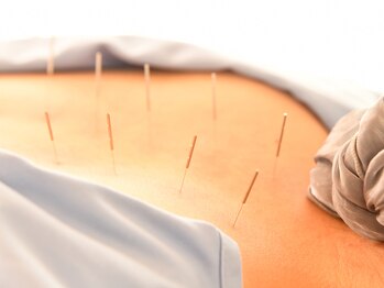 シュハリ(SHUHaRi)/鍼施術