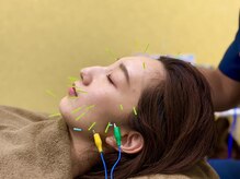 一ノ割みんなの鍼灸整骨院