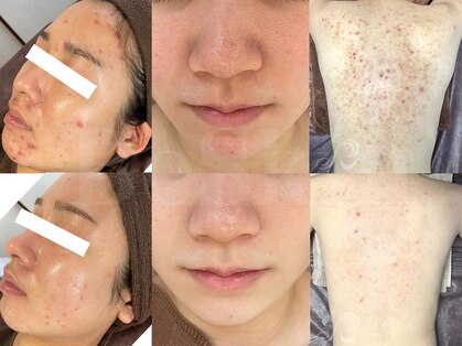 ビスキン(BeSkin)の写真