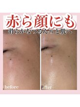 ホワイトアクア 天王寺本店(WHITE AQUA)/