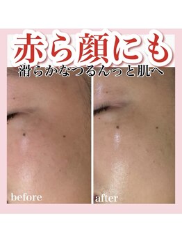 ホワイトアクア 天王寺本店(WHITE AQUA)/