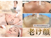 グラチア(Gratiae)