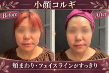 アフロディーテ 横浜(Aphrodite)