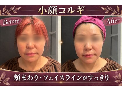 アフロディーテ 横浜(Aphrodite)の写真