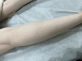 ナノハナ/鹿沼市の全身脱毛美容室ナノハナ