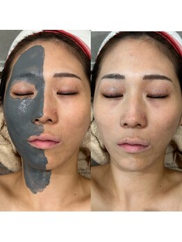 ディオーネ(Dione)/瞬間美白!ツヤッツヤモチモチ!