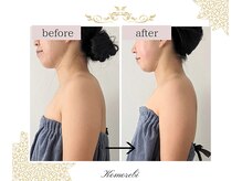 コモレビ(Komorebi)/