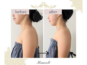 コモレビ(Komorebi)/