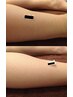 【18歳以下限定】ワキ・腕・足脱毛　30分