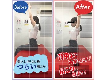 ナオル整体 西川口院(NAORU整体)/バンザイのチェック♪　柔軟性up