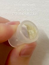 ゴールド 恵比寿店(GOLD)/毛穴洗浄で取れた【毛穴汚れ】