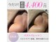 ビーグレイス(Vigrace)の写真
