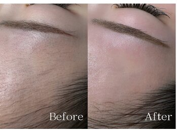 シルビー(CILBE)/人気メニュー/フェイシャルWAX