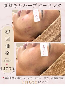 ノット(knote)/衝撃ビフォアフ5