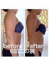 ウラヤス 恵比寿(Urayasu)/セル脂肪